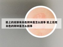 脸上的皮肤有白色斑块是怎么回事 脸上出现白色的斑块是怎么回事