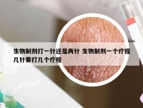 生物制剂打一针还是两针 生物制剂一个疗程几针要打几个疗程