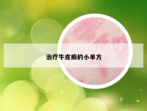 治疗牛皮癣的小单方