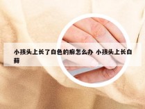 小孩头上长了白色的癣怎么办 小孩头上长白藓