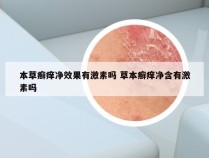 本草癣痒净效果有激素吗 草本癣痒净含有激素吗