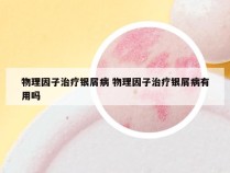 物理因子治疗银屑病 物理因子治疗银屑病有用吗