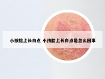 小孩脸上长白点 小孩脸上长白点是怎么回事