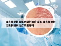 强直性脊柱炎生物制剂治疗效果 强直性脊柱炎生物制剂治疗效果好吗