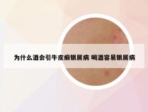 为什么酒会引牛皮癣银屑病 喝酒容易银屑病