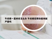 牛皮廨一直掉皮怎么办 牛皮廨后期会越来越严重吗