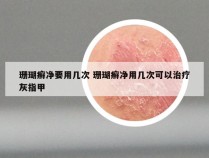 珊瑚癣净要用几次 珊瑚癣净用几次可以治疗灰指甲