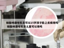 硝酸咪康唑乳膏可以15岁孩子脸上皮癣用吗 硝酸咪康唑乳膏儿童可以用吗