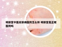 明肤堂中医皮肤病医院怎么样 明肤堂是正规医院吗