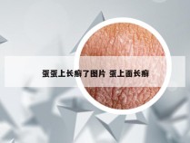 蛋蛋上长癣了图片 蛋上面长癣