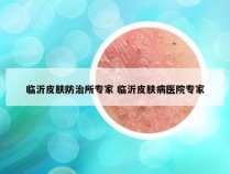 临沂皮肤防治所专家 临沂皮肤病医院专家