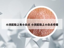 小孩屁股上有小白点 小孩屁股上小白点疙瘩