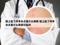 腿上起了好多白点是什么原因 腿上起了好多白点是什么原因引起的