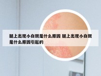 腿上出现小白斑是什么原因 腿上出现小白斑是什么原因引起的