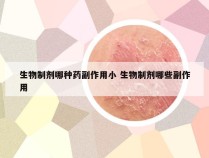 生物制剂哪种药副作用小 生物制剂哪些副作用