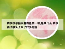 四岁孩子额头有白色的一块,是缺什么 四岁孩子额头上长了好多痘痘