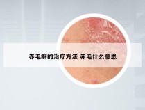 赤毛癣的治疗方法 赤毛什么意思