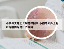 小孩冬天身上长癣是咋回事 小孩冬天身上起红疙瘩很痒是什么原因