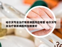 哈尔滨专业治疗银屑病医院在哪里 哈尔滨专业治疗银屑病医院在哪里好