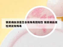 银屑病血清是否会有梅毒假阳性 银屑病血液检测说有梅毒