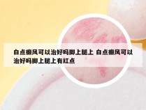 白点癫风可以治好吗脚上腿上 白点癫风可以治好吗脚上腿上有红点