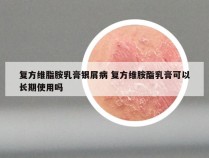 复方维脂胺乳膏银屑病 复方维胺酯乳膏可以长期使用吗