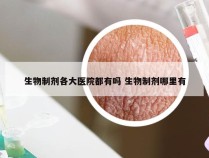 生物制剂各大医院都有吗 生物制剂哪里有