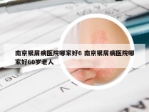 南京银屑病医院哪家好6 南京银屑病医院哪家好60岁老人