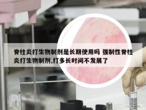 脊柱炎打生物制剂是长期使用吗 强制性脊柱炎打生物制剂,打多长时间不发展了