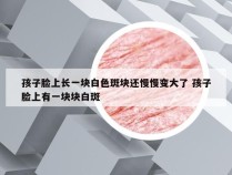 孩子脸上长一块白色斑块还慢慢变大了 孩子脸上有一块块白斑