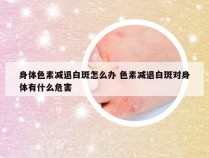 身体色素减退白斑怎么办 色素减退白斑对身体有什么危害