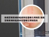 脓疱型银屑病的临床特征是哪几项阳性 脓疱型银屑病的临床特征是哪几项阳性的