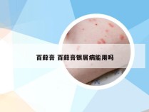 百藓膏 百藓膏银屑病能用吗