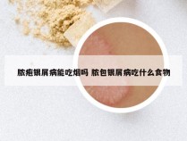 脓疱银屑病能吃烟吗 脓包银屑病吃什么食物