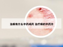 治癣有什么中药成药 治疗癣的中药方