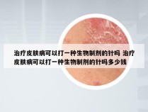 治疗皮肤病可以打一种生物制剂的针吗 治疗皮肤病可以打一种生物制剂的针吗多少钱