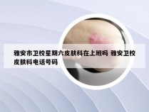 雅安市卫校星期六皮肤科在上班吗 雅安卫校皮肤科电话号码