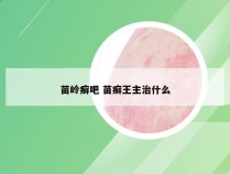 苗岭癣吧 苗癣王主治什么