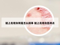 腿上出现白斑是怎么回事 腿上出现白色斑点