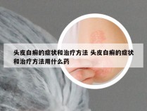 头皮白癣的症状和治疗方法 头皮白癣的症状和治疗方法用什么药