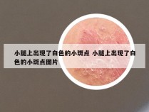 小腿上出现了白色的小斑点 小腿上出现了白色的小斑点图片