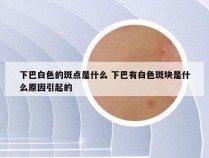 下巴白色的斑点是什么 下巴有白色斑块是什么原因引起的