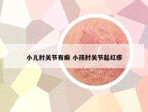 小儿肘关节有癣 小孩肘关节起红疹