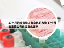 17个月的宝宝脸上有白色的大块 17个月宝宝脸上有白斑怎么回事