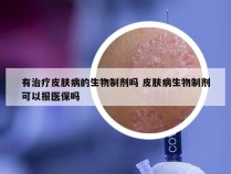 有治疗皮肤病的生物制剂吗 皮肤病生物制剂可以报医保吗