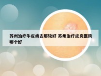 苏州治疗牛皮病去那较好 苏州治疗皮炎医院哪个好