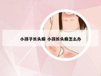 小孩子长头癣 小孩长头癣怎么办