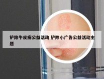 铲除牛皮癣公益活动 铲除小广告公益活动主题