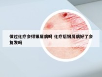 做过化疗会得银屑病吗 化疗后银屑病好了会复发吗