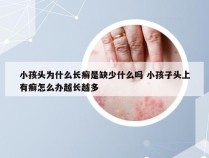 小孩头为什么长癣是缺少什么吗 小孩子头上有癣怎么办越长越多